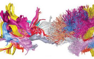 Two brain connectomes identified in a human brain using different methods for mapping human white matter in vivo